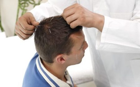 Craneopuntura-1-500x333