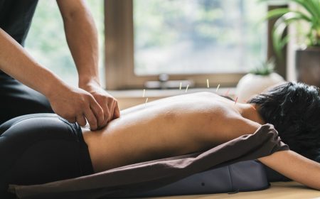 therapist-giving-cupping-treatment-to-young-asian--7rdmvyf_optimized